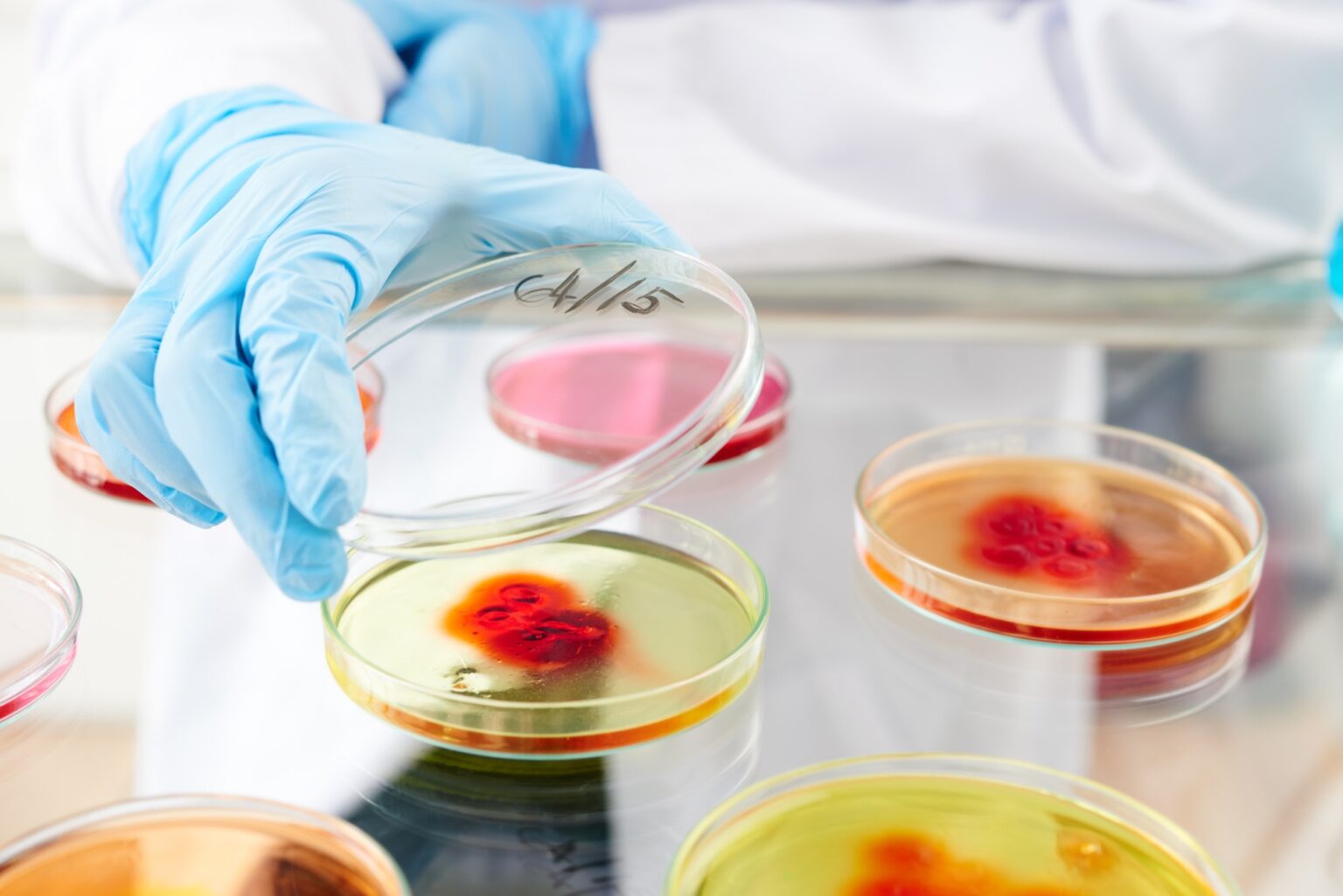 Cannabidiol helps fight antibiotic-resistant bacteria - AccuScience Laboratories